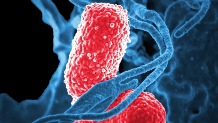 Зашкаливающая безработица в США на фоне пандемии контрастирует с опережающими мерами РФ